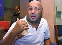 Pjevače bije ko god stigne