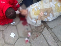 Sarajevo: Starica usred dana na ulici opljačkana i povrijeđena FOTO