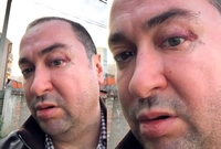 Đanija pretukli i opljačkali ispred kuće