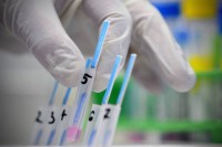 У УКЦ РС тренутно хоспитализована 52 пацијента са вирусом грипа