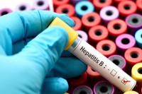 Данас бесплатно тестирање на вирусе хепатитиса Б и Ц