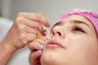 Инјекције ботокса дају и козметичари