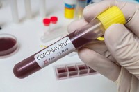 Prvi slučaj zaraze virusom korona u Širokom Brijegu, u samoizolaciji i ljekari i medicinske sestre