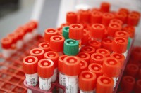 U FBiH četiri nova slučaja zaraze virusom korona,  do sada tri lica preminula