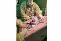 Бијељина: Прва беба рођена у изолацији и породиља негативни на вирус корона