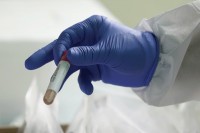 Zaraza virusom korona potvrđena kod još 11 osoba u FBiH