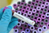 Dvije osobe zaražene virusom korona preminule u Univerzitetskom kliničkom centru Republike Srpske