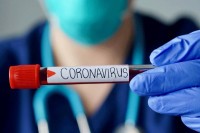 Pet studenata iz BiH u Češkoj pozitivno na virus korona