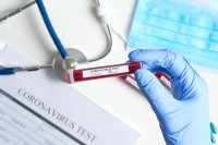 Još jedna žrtva virusa korona u Srpskoj