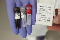 Nova žrtva virusa korona u Srpskoj: Preminuo muškarac u Bijeljini