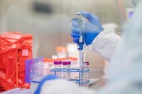 Šeranić: Uzimanje uzoraka od svih koji imaju bilo kakvu respiratornu infekciju