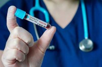 Još 16 osoba zaraženo koronom u BiH
