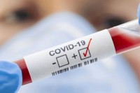 Prvi slučaj virusa korona u Kiseljaku