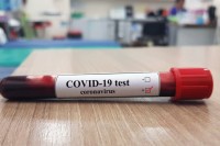 Virus korona u BiH: Potvrđeno ukupno 1.309 slučajeva, više od trećine oboljelih se oporavilo