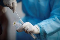 Institut za javno zdravstvo: U protekla 24 časa obavljen rekordan broj testiranja