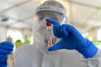 Stručnjaci upozorili: Zabrinjavajući broj zaraženih u RS u 9. sedmici epidemije, slabljenje discipline vodi do goreg scenarija