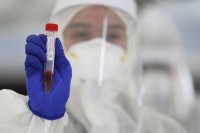 Virusom korona zaraženo još 53 ljudi u RS, među njima zdravstveni i radnici staračkog doma