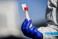 U BiH više od 2.000 slučajeva zaraze virusom korona, oporavile se 954 osobe