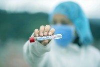 Virus korona odnio još jedan život, u Srpskoj novih 14 zaraženih