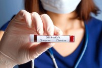 Virus korona potvrđen kod još 23 osobe u Srpskoj, najviše novozaraženih u Doboju