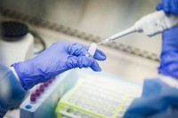 BiH: Od KOVID-19 oporavilo se 2.063 osoba