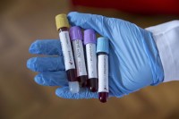 Старија жена из Теслића преминула, 21 особа позитивна на вирус корона