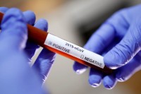 Virus korona potvrđen kod još 12 ljudi, najviše novozaraženih u Kostajnici
