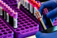 FBiH: Testirano 778 uzoraka, 33 pozitivna