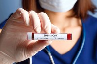 Raste broj zaraženih u Srpskoj: Virus korona potvrđen kod 60 ljudi, jedna osoba preminula