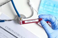 Pogoršana epidemiološka situacija u Srpskoj, u Srpcu oboljeli djeca i radnici vrtića