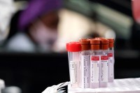 Стевандић: Недисциплина и попуштање мјера довели до раста броја заражених