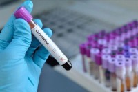 Rekordnih skoro 300 novozaraženih u BiH, ljekari upozoravaju: Stanje je alarmantno, virus nije farsa