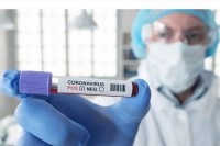 Proglašena epidemija Kovida-19 na teritoriji FBiH, zaraženo još 122 ljudi