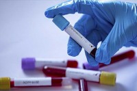 U Srpskoj još 86 slučajeva virusa korona, ukupno 3607 zaraženih