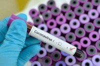 Preminula jedna osoba zaražena virusom korona, laboratorije u RS nisu obavljale testiranja tokom proteklog dana
