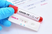 U Srpskoj još 45 novozaraženih, dvije osobe preminule