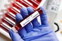 Virusom korona zaraženo još 146 ljudi, preminula dva muškarca