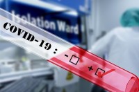 Virusom korona zaraženo još 136 ljudi u Srpskoj, preminule tri osobe