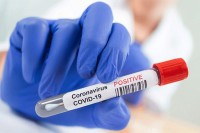Virus korona potvrđen kod još 109 ljudi u Srpskoj, troje zaraženih preminulo