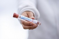 И туристима доступни PCR тестови