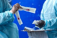 Virus korona potvrđen kod još 98 ljudi u Srpskoj, preminulo šestoro zaraženih