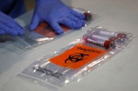 Комерцијални тестови на вирус корона од данас јефтинији за 50 КМ