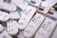 Серолошки тест у Заводу за трансфузијску медицину кошта 45 КМ
