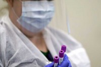 Još 73 osobe zaražene koronom u Srpskoj, dve umrle