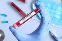 U Srpskoj još 43 osobe zaražene virusom korona, tri preminule