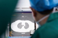 Dobra vijest: Pluća oštećena virusom mogu da se oporave za tri mjeseca