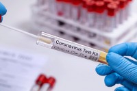 Продужене мјере за БиХ: У Хрватску само са негативним PCR тестом