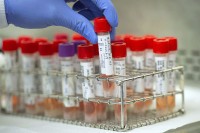 U Srpskoj virus korona potvrđen kod još 74 osobe, dvoje preminulo