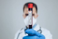 FBiH: Zaraženo još 160 lica, tri smrtna slučaja