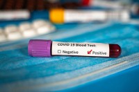 Švedska: Epidemija možda gotova, dovoljno ljudi steklo imunitet